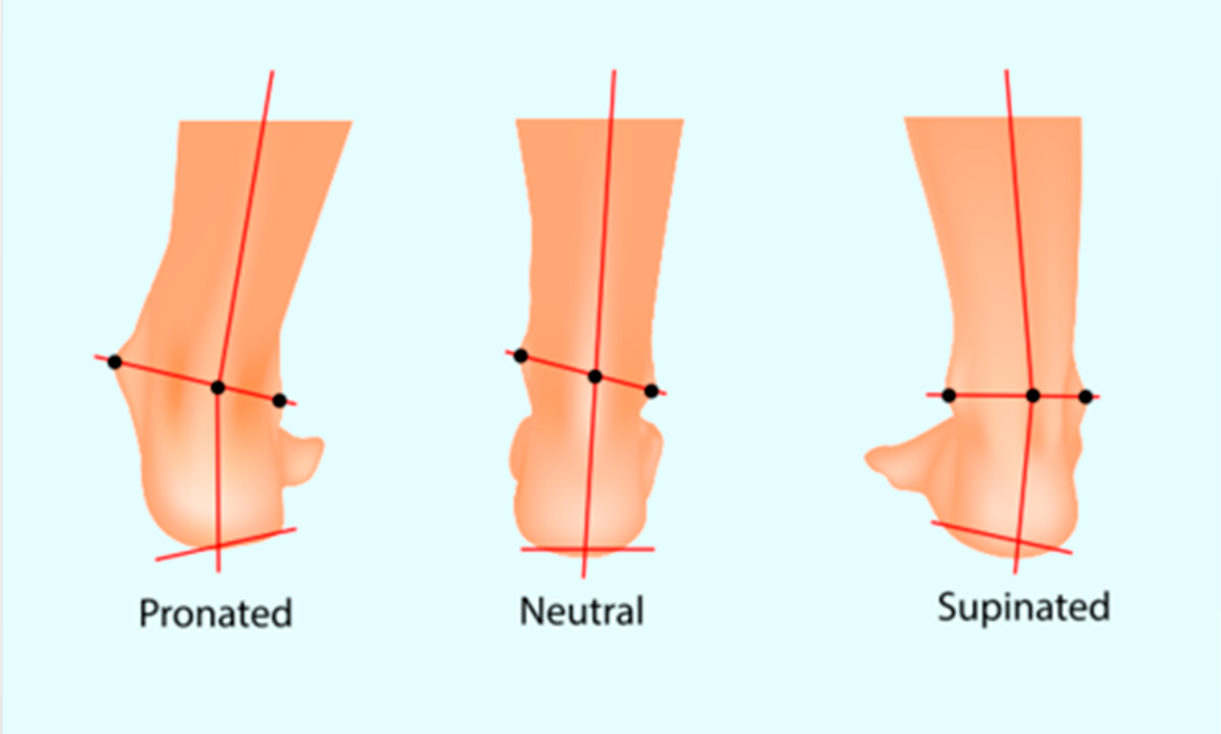 SUPINATION